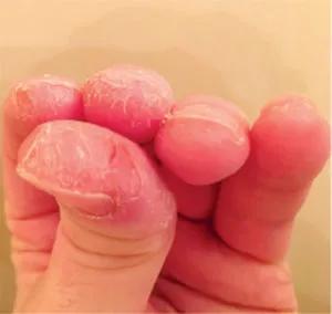 Fingers