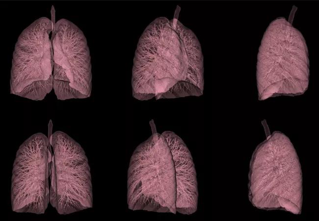 Detecting Lung Cancer: Pearls for Primary Care Physicians