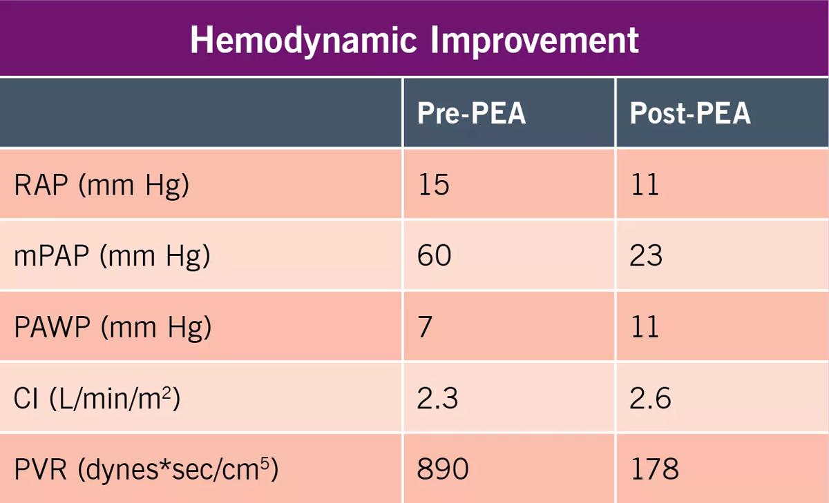 Pre-PEA/Post-PEA Chart