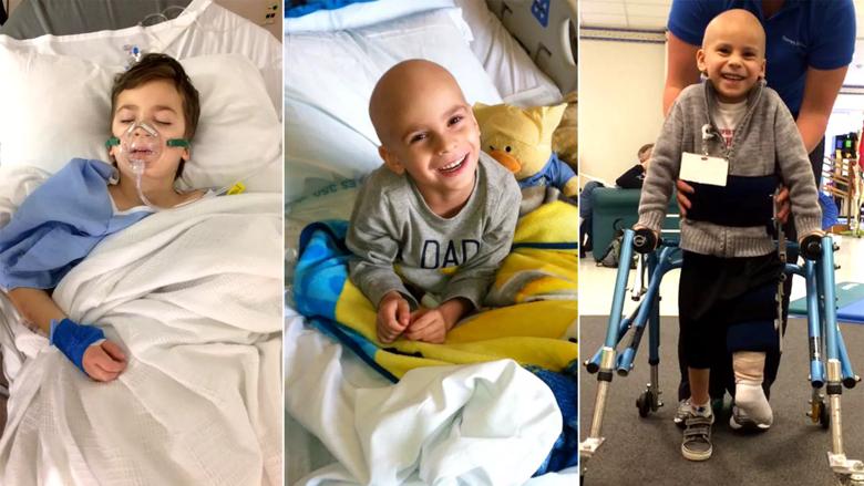 Boy with cancer undergoes rotationplasty surgery at Cleveland Clinic
