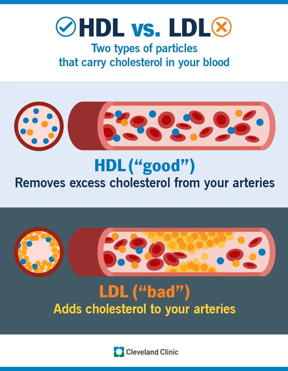 HDL vs. LDL particles