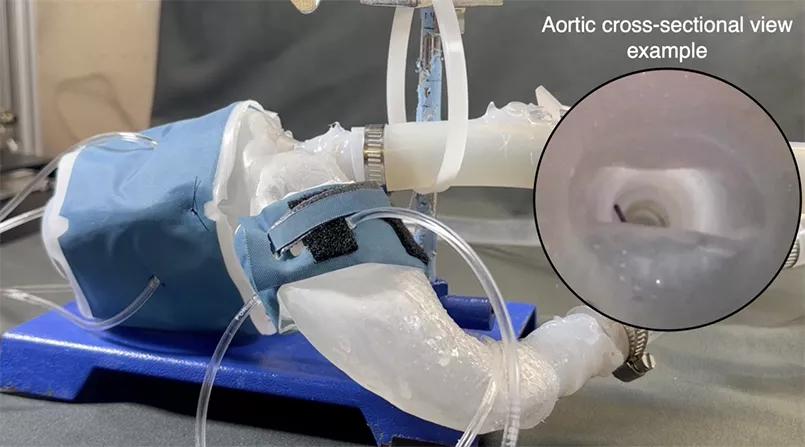 3D-printed model of left ventricle, aorta and aortic valve