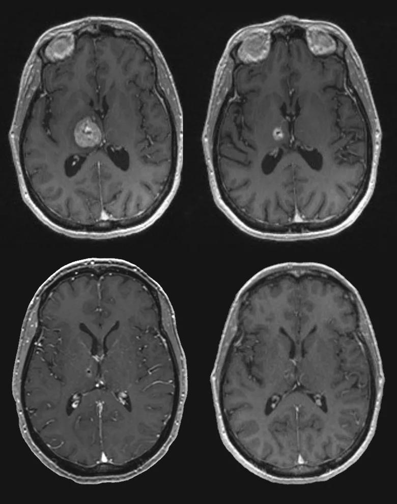 16-neu-2600-angelov-inset