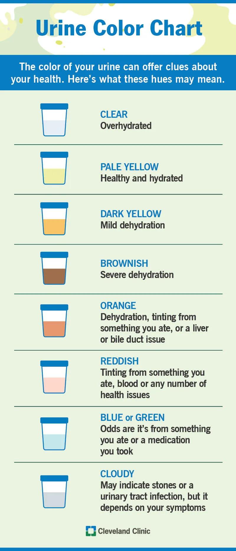 Urine colors and what they could mean about your health