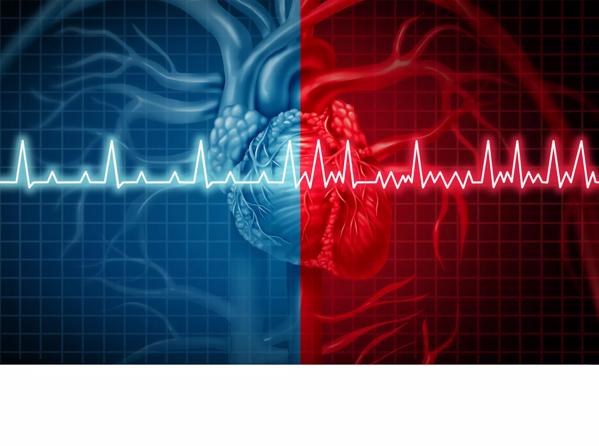 Atrial Fibrillation