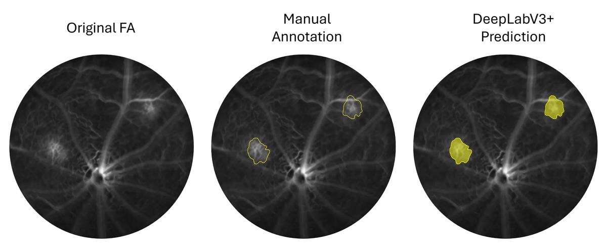 3 circles with white lines on a black background and yellow outlines