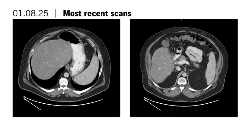 Most recent scan