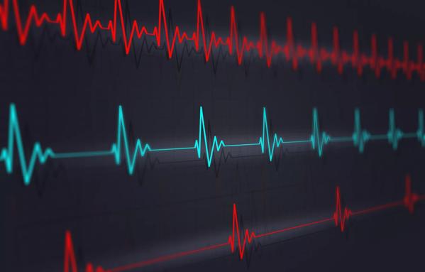 Fast Normal Slow Heartbeat Examples