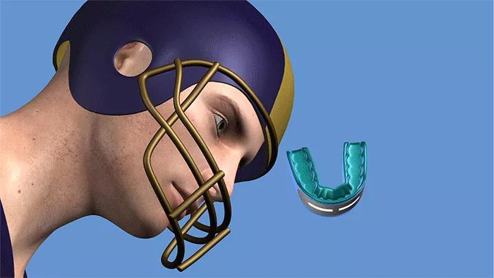 Cleveland-Clinic-Intelligent-Mouthguard