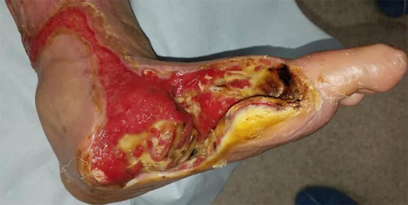 Foot