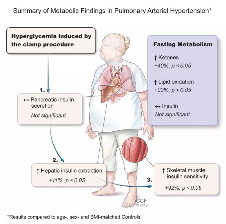 Pulmonary