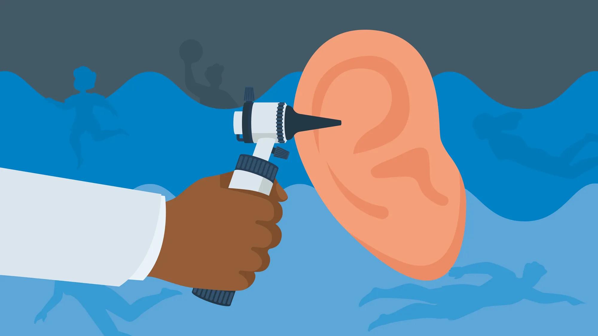 Acute Otitis Externa: An Update | AAFP, image size:2000x1125