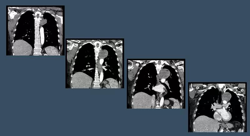 Figure 2 of presentation
