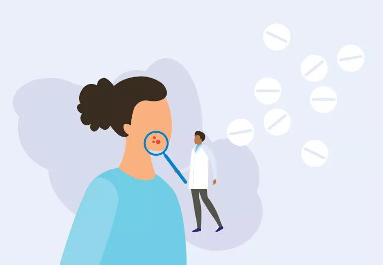 Should I Take Spironolactone for Acne?