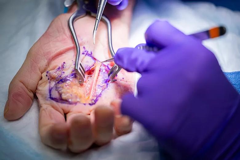 Students hold surgical tools over a dissected hand that shows nerves and tendons