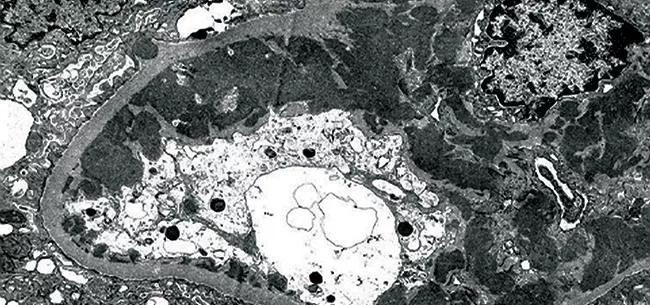 15-RHE-962 CQD_Inset Figure 3