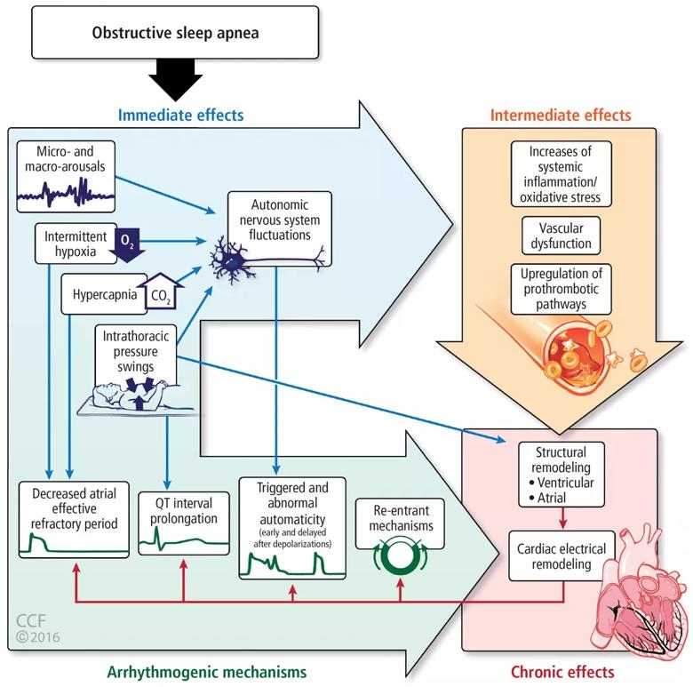 Chart showing sleep apnea effects