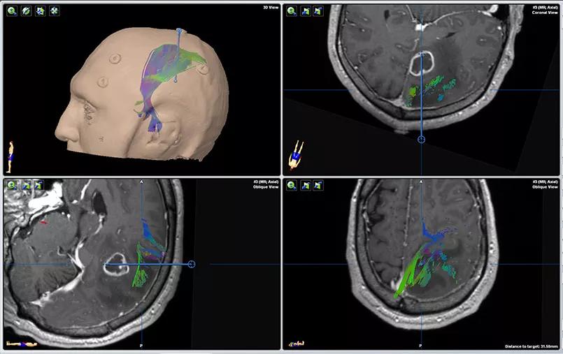 CT scans of the brain.