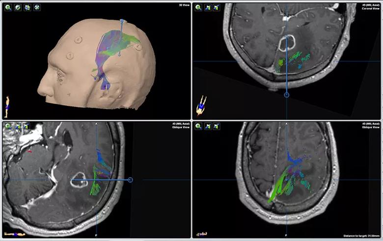 CT scans of the brain.