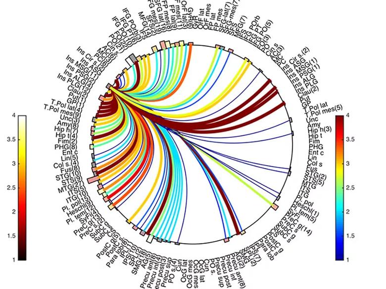 Circle map showing example connectivity from one region to other regions of interest for six patients