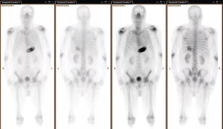 Full-body planar scan.