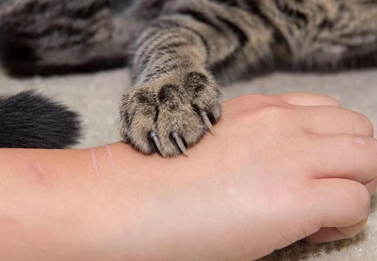 What You Should Do for a Cat Bite or Scratch