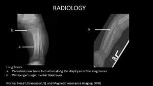 X-RAYS