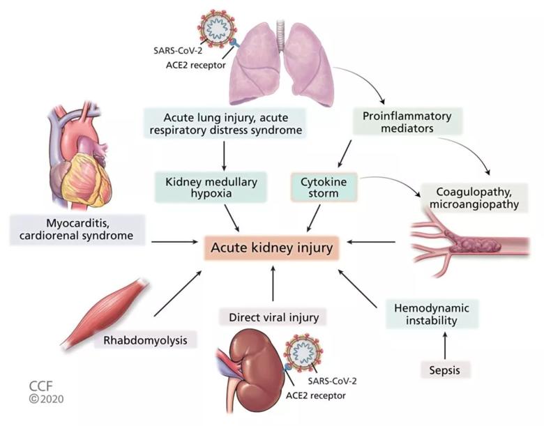 Pathophysiology of acute kidney injury in COVID-19.