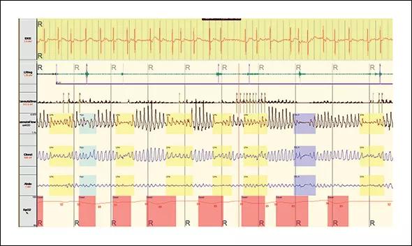 Inset-Mehra-Fig1