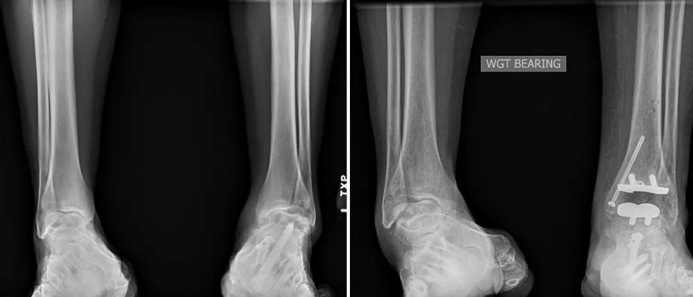 X-ray scans of the ankle.