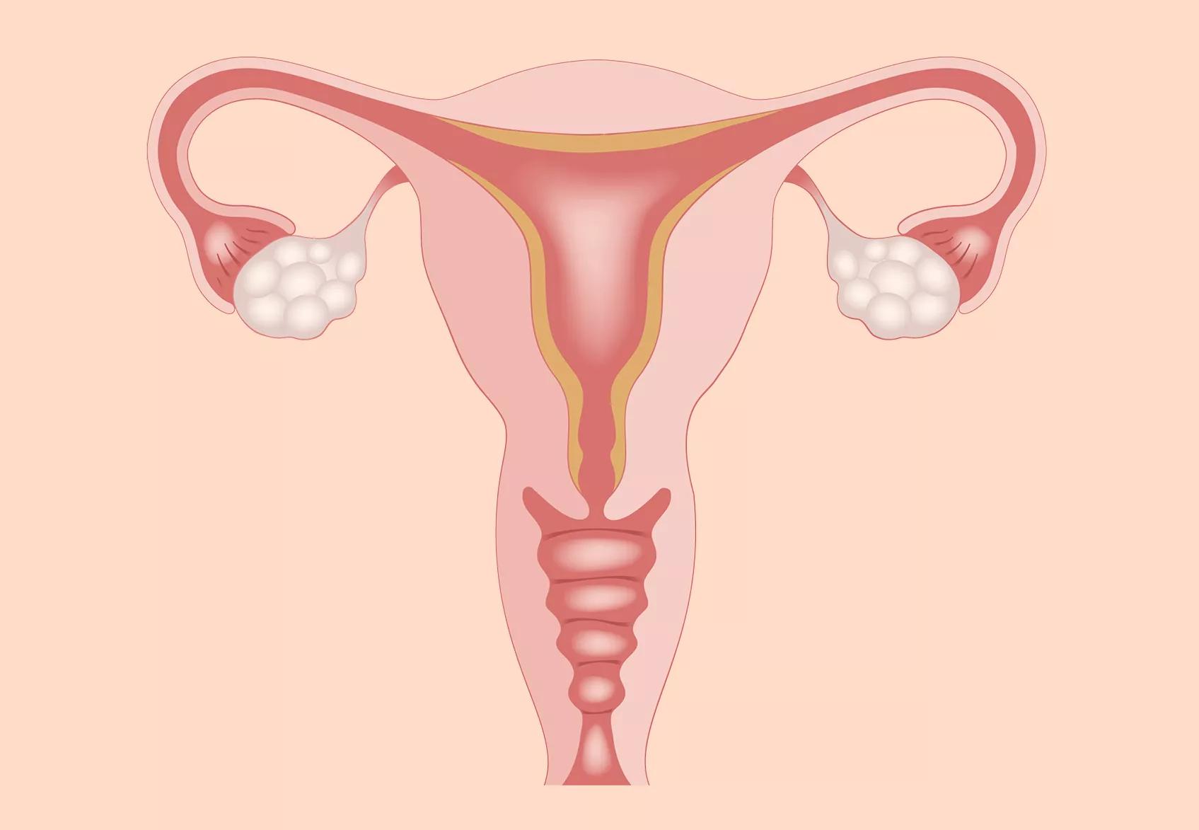 Pain in right ovary then gush of discharge — The Bump