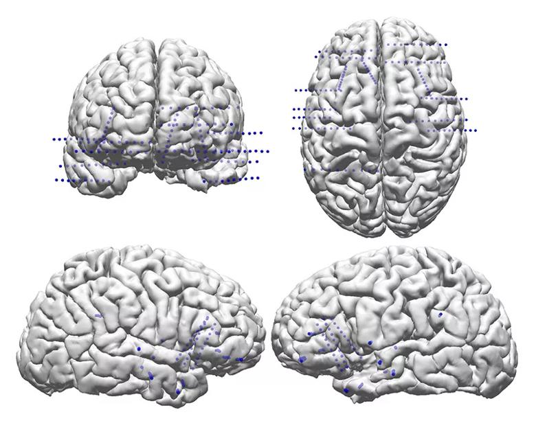 Inset Fig-3