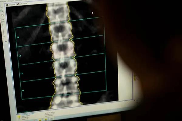 Spine xray