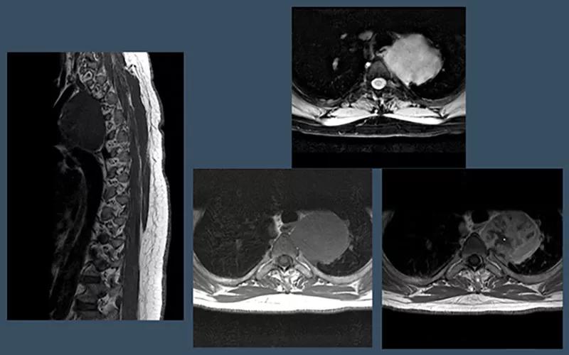 Figure 1 of presentation