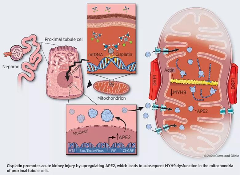 Chemotherapy associated kidney damage