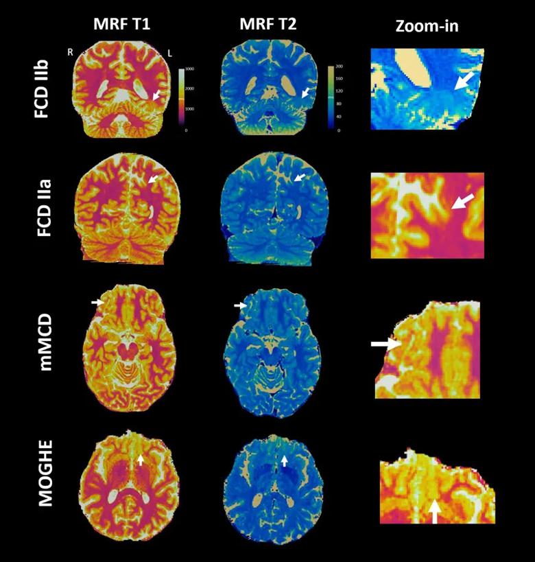 rows of colorful brain scans against a black background