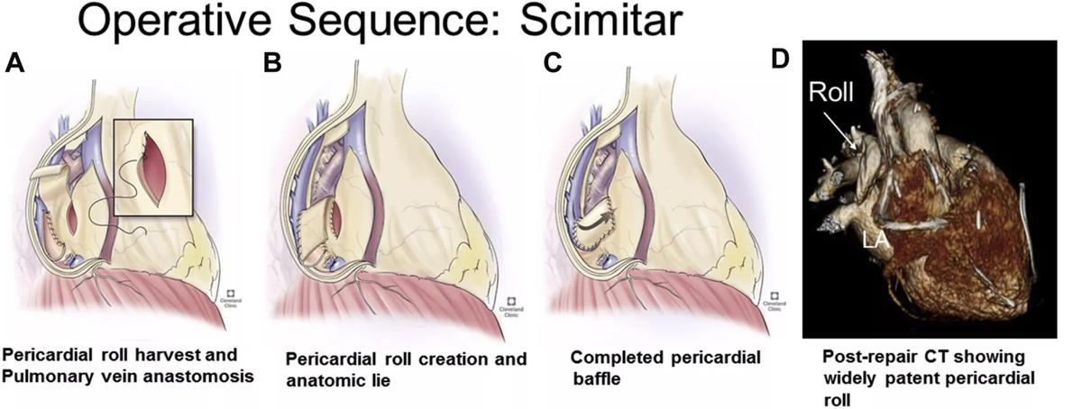 Chart organizing anatomic configurations and demographics of our early experience