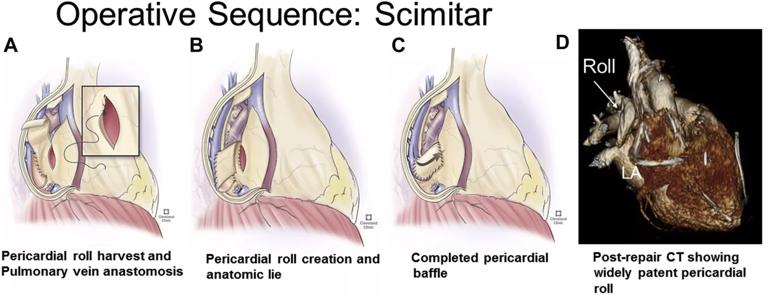 Chart organizing anatomic configurations and demographics of our early experience