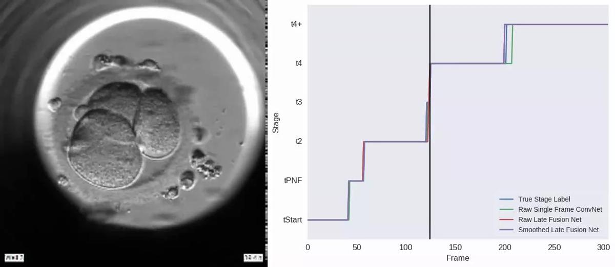 Convolutional neural network (CNN) model accurately identifies early embryo morphokinetic annotations. 
