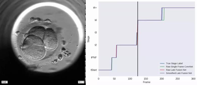 Convolutional neural network (CNN) model accurately identifies early embryo morphokinetic annotations. 
