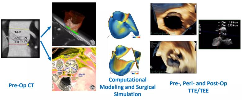 Imaging for valve repair