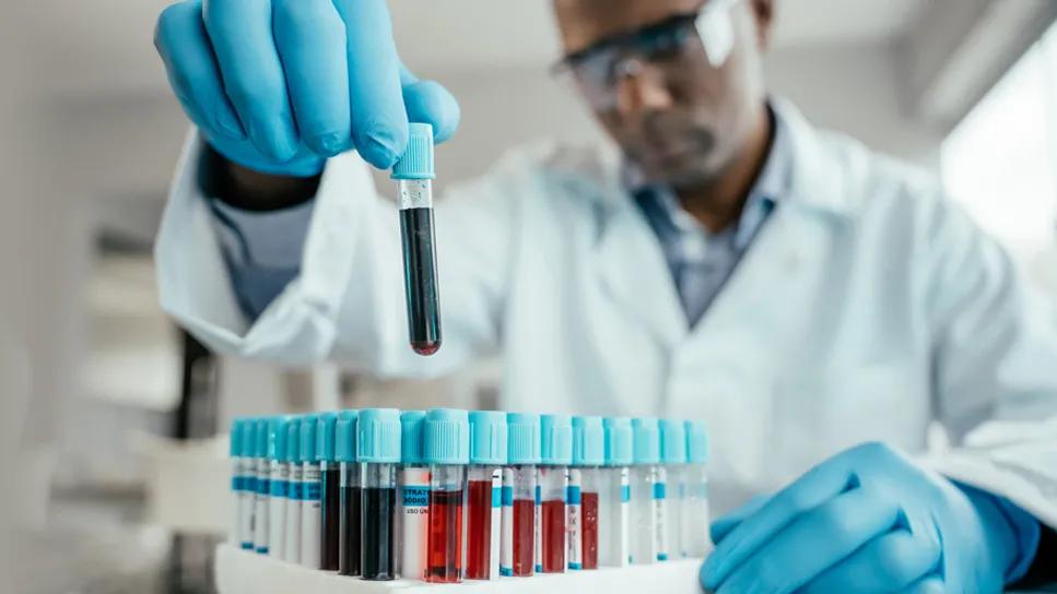 Can Covid Raise Blood Sugar: Unveiling the Connection