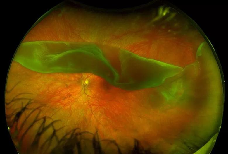 Orange area inside the eye with a green flap