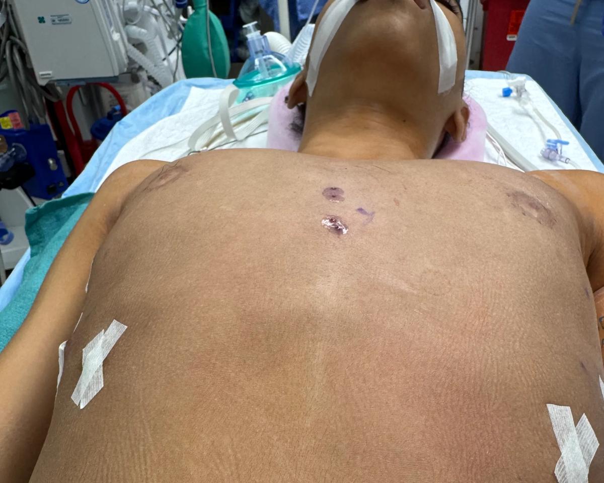 Photo of patient's chest