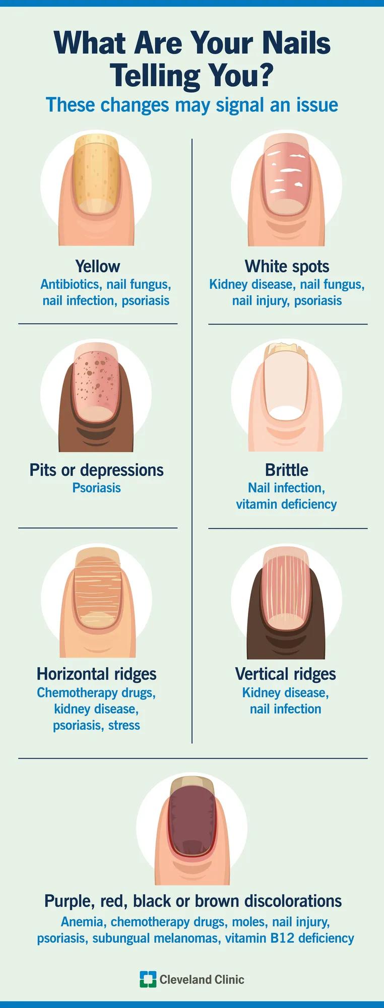 Nail change symptoms and possible causes