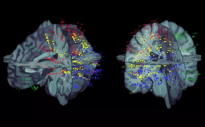 SEEG contacts from four patients warped to a common atlas using open-source brainstorm software