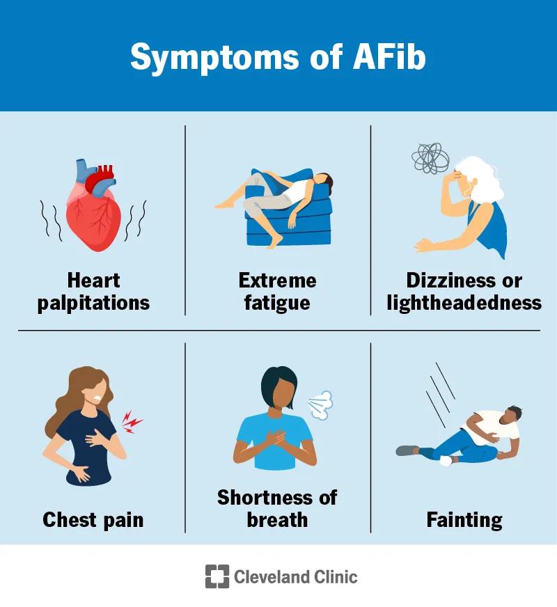 AFib symptoms, including chest pain, heart palpitations, shortness of breath and fainting