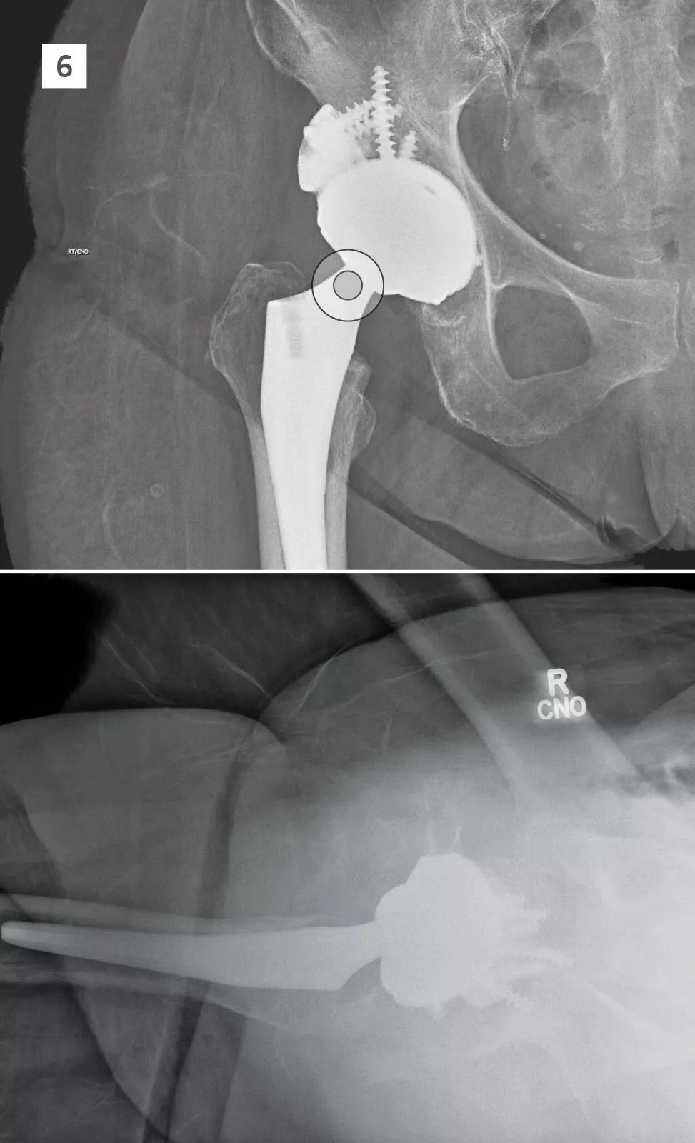 Scans of hip joint