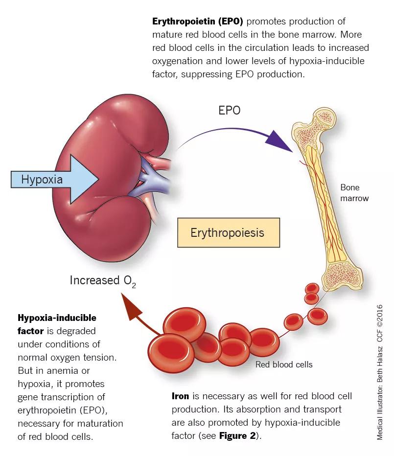 Anemia