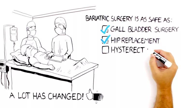 "Bariatric surgery is as safe as other types of surgery" drawing